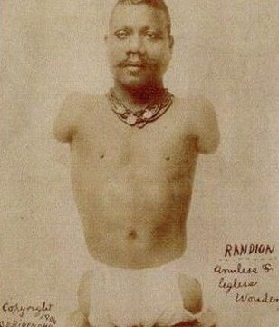 Prince Randian