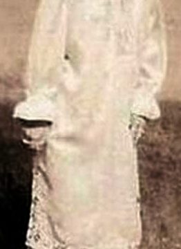 Schlitzie